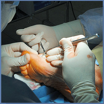 operation