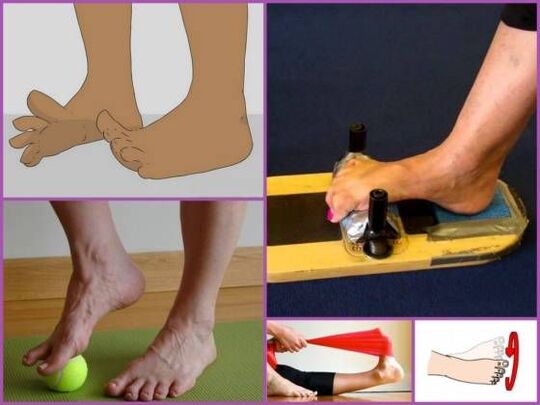 Gymnastics therapy for plano-valgus foot deformity