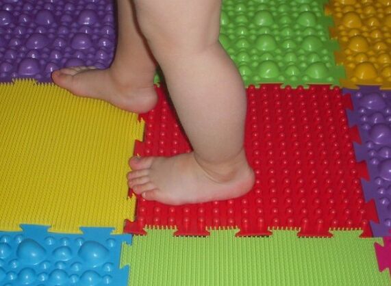 Preventing a Valgus pathology